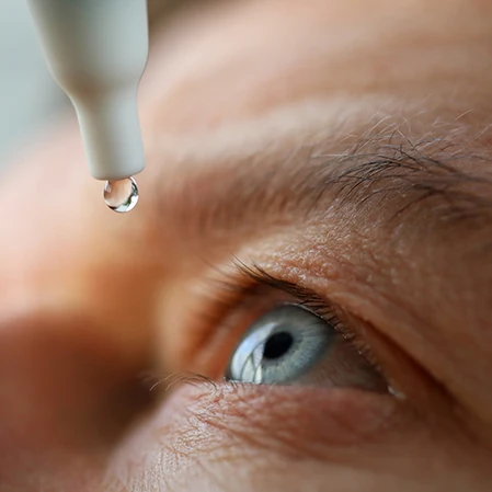 Close up of an eye dropper hovering a bead of solution over a pale blue eye